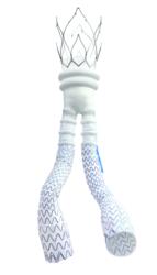 TriVascular Ovation Abdominal Stent Graft System